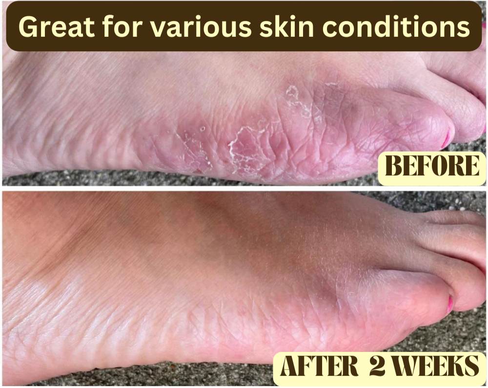 Beef Tallow Honey Balm