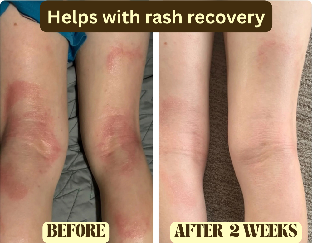 Beef Tallow Honey Balm