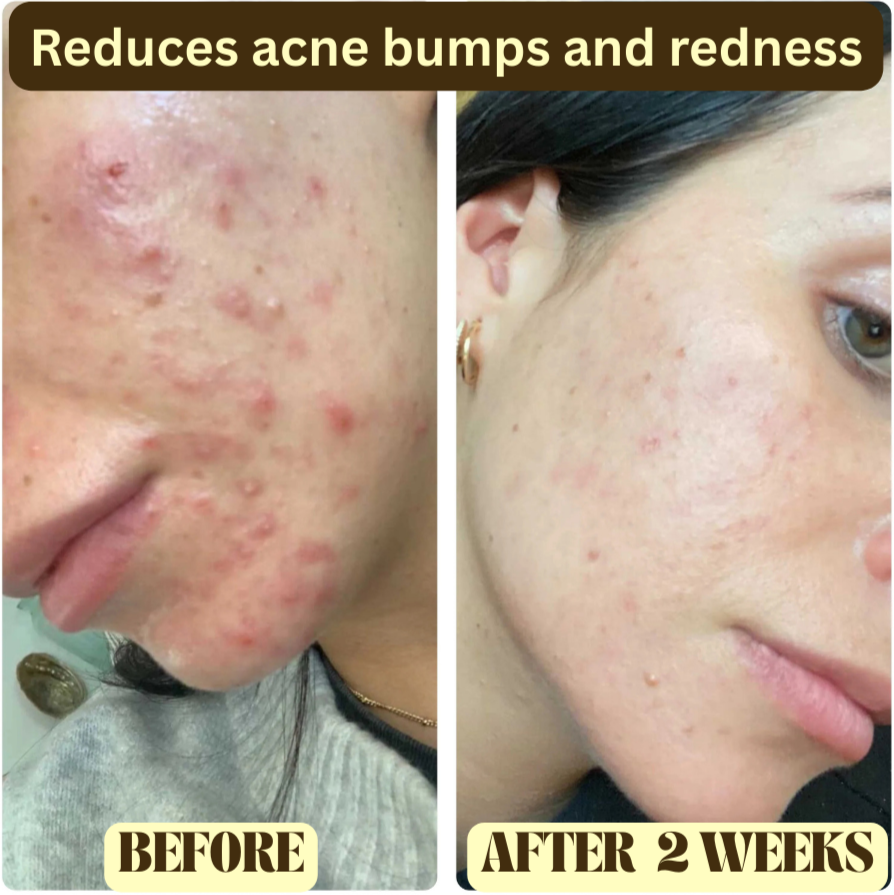 Beef Tallow Honey Balm