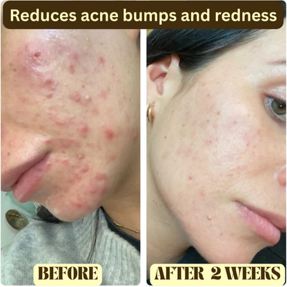 Beef Tallow Honey Balm